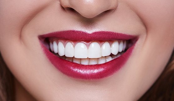 Close up of a person's smile with straight white teeth and red lips