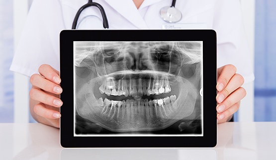 Digital dental x rays on a tablet screen
